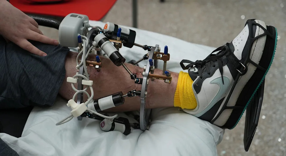 Trey Harrison, who was injured in a crash on March 30, 2025, will get to go home next week after spending several months and undergoing dozens of surgeries at the Nemours Children's Hospital.
